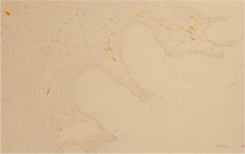 Figure 7 p16-negative staining (×10).