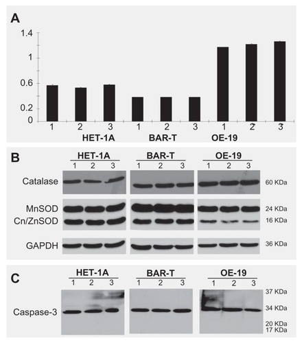 Figure 4 Effects of gold nanoparticle loading and exposure to near infrared light in three esophageal cell lines. (A) Effect of gold nanoparticles and near infrared light on cell viability in all three cell lines. There is no difference in cell viability after treatment with gold nanoparticles alone or exposure to near infrared light alone. (B) The effect of gold nanoparticles and nIR light on MnSOD, Cu/ZnSOD and catalase in three cell lines. There is no difference for the key protective proteins (catalase, MnSOD, Cu/ZnSOD, and GAPDH) in three cell lines. (C) The effect of gold nanoparticles and near infrared light on caspase-3 in all three cell lines.Notes: Caspase-3 expression is in an inactive form in all three cell lines and no active forms, such as p20 or p17, were cleaved in the three cell lines after treatment with gold nanoparticles or exposure to near infrared light.