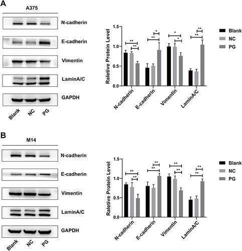 Figure 2 Progerin altered the expression of EMT hallmark proteins in A375 cells and M14 cells. (A and B) Western blot was used to detect the changes in the expression levels of proteins (N-cadherin, E-cadherin, Vimentin, progerin) in the A375 cell group and the M14 cell group, and statistical analysis was performed on the protein expression levels. Histograms represent relative protein expression. Data are expressed as mean ± SD of three independent experiments. *P<0.05, **P <0.01.