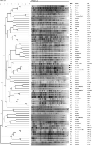 Figure 2 Pulsed field gel electrophoresis (PFGE) cluster analysis of 68 strains of HvKP from different sources. Four highly homologous isolates from carbapenemase producing HvKP have been marked with a black circle to the serial number left.