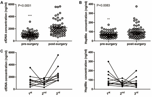 Figure 6 Concentrations of plasma cfDNA and Hsp90α before and after surgery. (A) Scatter plot of cfDNA concentrations before and after surgery. (B) Scatter plot of Hsp90α concentrations before and after surgery. (C) Dynamic monitoring of cfDNA and Hsp90α concentrations in 10 ESCC patients who received chemotherapy and underwent curative resection successively. 1st, 2nd and 3rd mean different time points of detecting as showed in Figure 1. **P < 0.01, ***P < 0.001.