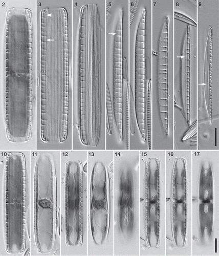 Figs 2–17. Three hantzschioid species from Loch Goil, LM, differential interference contrast optics: fixed and haematoxylin-stained cells (Figs 2, 3, 10–17) and acid-cleaned thecae and valves (Figs 4–9). Figs 2–4. Type A1 (Nitzschia dicrogramma): cell, frustule and theca in girdle view (Figs 3–5, respectively); note the line parallel to the raphe (arrow), which curves in towards the raphe at the pole (arrowhead; cf. Fig. 33), reflecting the presence of a conopeum. Figs 5, 6. Type A1 valve, two focuses (holotype of N. dicrogramma); note the line parallel to the raphe (Fig. 5, arrow). Fig. 7. Type A1 valve. Fig. 8. Type A2 valve (holotype of N. brachygramma); note the line parallel to the raphe (arrow). Fig. 9. Type B valve (holotype of N. parkii); note the line parallel to the raphe (arrow). Figs 10, 11. Type A1 cell (N. dicrogramma) in ventral and dorsal focus: note the two ventral chloroplasts (and large dorsal nucleus with two nucleoli). Figs 12–14. Type A2 cell (N. brachygramma) in ventral, mid and dorsal focus: the four chloroplasts are appressed to the valves, leaving a strip clear along the midline of the girdle on either side. Figs 15–17. Type B cell (N. parkii) in ventral, mid and dorsal focus: note the lobes of the chloroplast reaching the ventral side (Fig. 15), the small central nucleus, and the central part of each chloroplast lying against the dorsal side (Fig. 17). Scale bars = 10 µm (for Figs 2–9, see Fig. 9; for Figs 10–17, see Fig. 17).