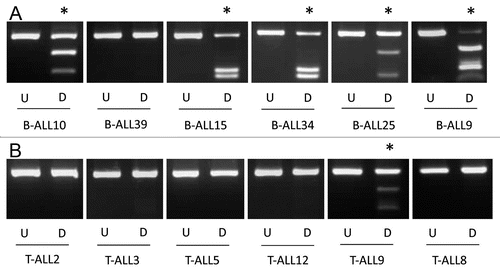 Figure 2 KIBRA methylation in ALL samples. CoBRA results are shown for six childhood B-ALL samples (A) and six childhood T-ALL samples (B). Undigested products (U) are shown next to BstUI digested products (D) for each sample. * indicates methylated samples.