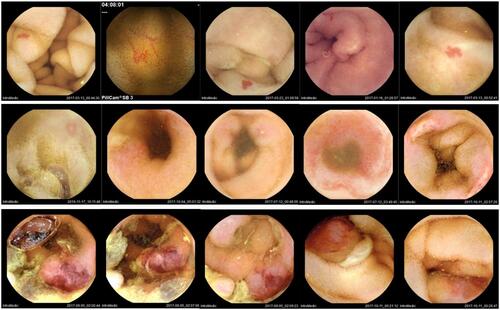 Figure 2 Some of the original images used in Phase 2. Top row: vascular lesions; middle row: inflammatory lesions; bottom row: neoplastic lesions.
