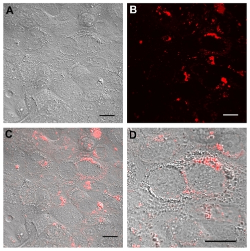 Figure 5 Real time confocal laser scanner microscopy images of Calu-3 cells exposed to Rhod-PLGA/PVA nanoparticles for 24 hours and subsequent washing of the medium. (A) Nomarski image, (B) fluorescent image, and (C) superimposition of Nomarski and fluorescence images, and (D) enlarged region of (C).Note: Scale bars = 20 μm.Abbreviations: PLGA, poly (lactide-co-glycolide); PVA, poly (vinyl alcohol); Rhod, rhodamine B alcohol.