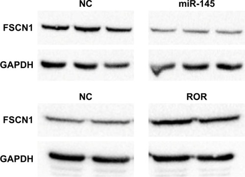 Figure 9 Overexpression of miR-145 downregulated FSCN1 (p<0.01) and ROR upregulated FSCN1 (p<0.05).