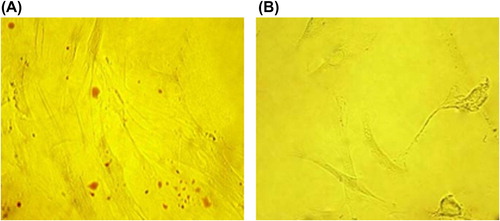 Figure 8. Oil Red O staining after adipogenic induction of ASCs. (A) Positive results at 2 weeks after adipogenic induction (× 400). (B) Negative results in the control group (× 400).