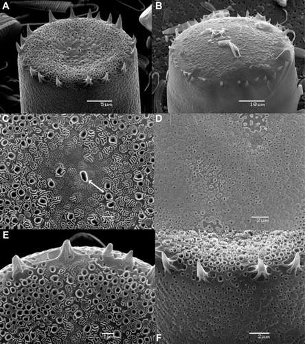 Figure 4  Scanning electron micrographs of Cavernosa kapitiana from Ile de la Possession. A, Concave valve face. B, Convex valve face. C, Detail of the surface structure of a concave valve showing three different ornamentation elements: pores, granules and ridges. The arrow indicates the position of the rimoportula. D, Surface structure of the valve mantle. E, Detailed valve face view of the stellate spines. F, Valve–mantle transition with the position of the spines. Scale bars, 10 μm except for (C,E), 1 μm.