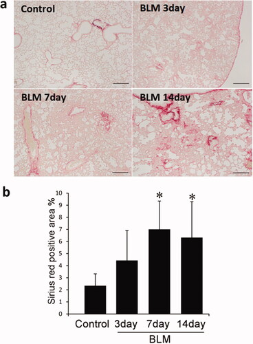 Figure 1. Pulmonary fibrosis induced by the administration of BLM. (a) Collagen was observed by Sirius Red staining using paraffin-embedded mouse lung sections 3, 7, and 14 days after the administration of BLM. Staining with Sirius Red was only observed around blood vessels in the control group treated with PBS. Collagen accumulation in the lung of animals was observed on days 3, 7, and 14 after the administration of BLM. (b) The graph indicates the accumulation in the lungs and represents the area of stained collagen in the section. P < 0.05 denotes a statistically significant difference. BLM: bleomycin; PBS: phosphate-buffered saline.