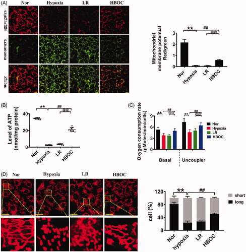 Figure 7. The protective effects of HBOC on mitochondria in hypoxic VECs. (A) The effects of HBOC on the membrane potential of mitochondria in hypoxic VECs (bar = 25 μm). (B) The effects of HBOC on the ATP levels in hypoxic VECs. (C) The effects of HBOC on the oxygen consumption rate in hypoxic VECs. (D) The protective effects of HBOC on the morphology of mitochondria in hypoxic VECs (bar = 25 μm). Mitochondria were considered short when the length of mitochondria < 7 μm and long when the length of mitochondria > 7 μm. Data are presented as mean ± SD (n = 8 observations per group). *p < 0.05 and **p < 0.01 as compared with normal group/sham operation group, #p < 0.05 and ##p < 0.01 as compared with shock group/hypoxia group; @p < 0.05 and @@p < 0.01 as compared with LR group. ATP: adenosine triphosphate; hypoxia: hypoxia group; HBOC: haemoglobin-based oxygen carrier; LR: lactated Ringer’s solution; Nor: normal group; Sham: sham operation group; VEC: vascular endothelial cells.