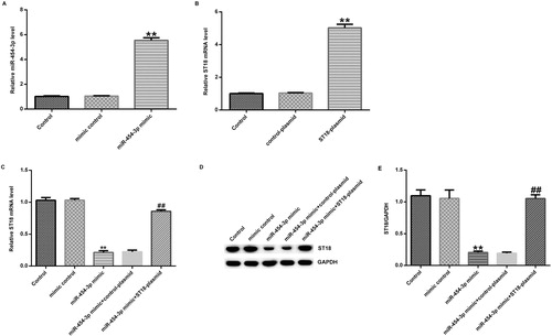 Figure 4. Effect of miR-454-3p on ST18 expression in primary cortical neurons. Primary rat neurons were transfected with miR-454-3p mimic, mimic control, ST18-plasmid, control-plasmid; miR-454-3p mimic + control-plasmid or miR-454-3p mimic + ST18-plasmid. Transfection efficiency was measured after 48 h. (A) Level of miR-454-3p in neurons transfected with mimic control or miR-454-3p mimics for 48 h determined using qRT-PCR; (B) ST18 mRNA level in neurons transfected with control-plasmid or ST18 plasmid for 48 h determined using qRT-PCR; (C) ST18 mRNA level in neurons transfected with mimic control, miR-454-3p mimic, miR-454-3p mimic + control-plasmid or miR-454-3p mimic + ST18-plasmid for 48 h determined using qRT-PCR; (D) ST18 protein level in neurons transfected with mimic control, miR-454-3p mimic, miR-454-3p mimic + control-plasmid or miR-454-3p mimic + ST18-plasmid for 48 h determined using western blot assay; (E) ratio of ST18 protein level/GAPDH protein level. Data are expressed as mean values ± SD. **p < 0.01 versus control group; ##p<.01 versus miR-454-3p mimic group.