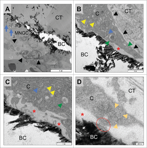 Figure 7. shows TEM pictures of the multinucleated giant cells adherent to the surfaces of BoneCeramic 500–1000 µm granules (BC) within the subcutaneous connective tissue (CT) of the CD-1 mouse on day 15 after implantation. (A) shows an overview of a material-adherent multinucleated giant cell (MNGC, black arrow heads) at the surface of the BoneCeramic 500–1000 µm (BC) that has invaginated material fragments (blue arrows) (1200x magnification, scale bar = 9 µm). (B) and (C) show a multinucleated giant cell (black arrow heads) adherent to a BC 500–1000 granule surface (BC). Within their cytoplasm (CP) mitochondria (blue arrow heads), many cisterns of the rough endoplasmic reticulum (rER, red arrow head) and different vesicles (green arrow heads) were found. Furthermore, a zone demarcated by the material surface and the cell membrane of the giant cell (red asterisks) was found that did not contain cell organelles but rather electron-dense content (B) 4800x magnification, scale bar = 2 µm; (C): 9300x magnification, scale bar = 1 µm). (D) Shows the adherent podosome-like cell branch (read dashed line) of the multinucleated giant cell (C = cytoplasm) at the surface of the bone substitute granule (BC) that seems to separate the demarcation zone (red asterisk) from the surrounding connective tissue (CT). Furthermore, a bundle of intracellular intermediate filaments were found near the cell branch (orange arrow heads) (23000x magnification, scale bar = 200 nm).