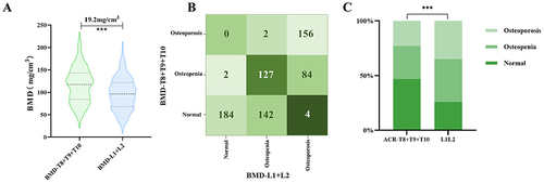 Figure 1 Role of thoracic vertebral bone mineral density (BMD-T8+T9+T10) in identifying osteopenia and osteoporosis based on one American College of Radiology (ACR) criterion. The difference between thoracic vertebral bone mineral density (BMD-T8-T10) and lumbar bone mineral density (LBMD) (A) The kappa test showed moderate agreement in identifying osteoporosis between BMD-T8-T10 and lumbar spine BMD (kappa = 0.51) (B). Compared to those in the gold standard group, the proportions of osteopenia and osteoporosis defined by BMD-T8+T9+T10 groups were significantly different (C) ***, P < 0.001.