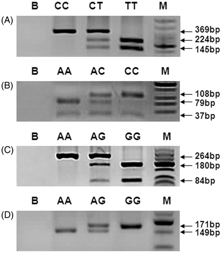 Figure 2. PCR-RFLP analysis of MTHFR c.677C > T (A), MTHFR c.1298A > C (B), MTR c.2756A > G (C), and MTRR c.66A > G (D) polymorphisms. PCR-RFLP: polymerase chain reaction-restriction fragment length polymorphism; B: blank; M: low molecular weight DNA ladder.