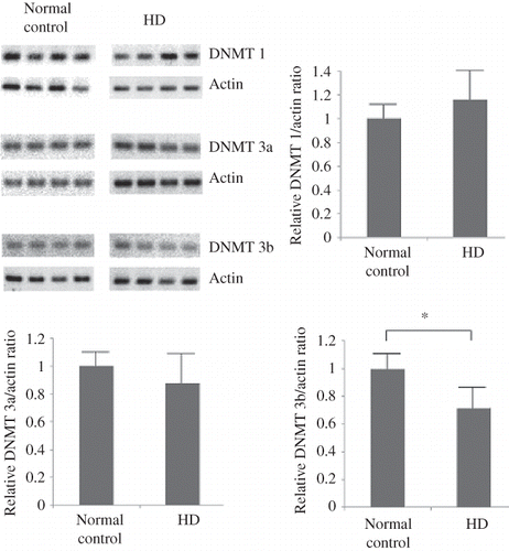 Figure 2. Quantitative PCR analysis for DNMT 1, 3a, and 3b mRNA expression in the leukocytes of the study subjects. The mRNA expression of DNMT 1 and 3a was not significantly different between the normal subjects (n = 20) and the chronic HD patients (n = 20). The DMNT 3b mRNA expression decreased significantly in the chronic HD patients. *p < 0.05.