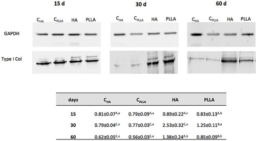 Figure 5 Representative immunoblot of type I collagen expression on dermal skin after 15, 30 and 60 days of dermal filler treatment. Densitometric quantification (in arbitrary units, AU) normalizing protein loading to GAPDH. Different uppercase letters represent significant differences among the groups at each experimental time point. Different lowercase letters indicate significant differences at different time points.