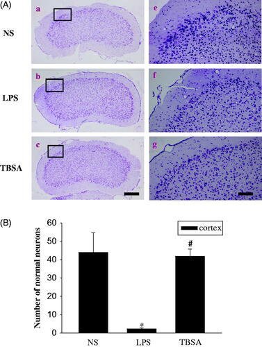 Figure 5. HDAC6 inhibition diminishes neuronal damage in the frontal cortex. Typical images of cresyl violet-stained sections from the frontal cortex of the NS group (a, d), mice injected with LPS (b, e) and mice treated with both LPS and TBSA (c, f). Data were obtained from six independent animals in each experimental group and the results of a typical experiment are presented here. Boxed areas in the left column are shown at higher magnification in the right column. Scale bar in d = 200 μm; Scale bar in h = 20 μm. (B) The cell density in the frontal cortex was calculated. Data were obtained from six independent animals in each experiment group. *p < 0.05 compared with the respective saline group; #p < 0.05 compared with the respective LPS group.