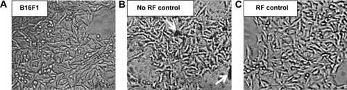 Figure 7 Optical microscopic images (100×) of (A) B16F1 cells, (B) no RF control cells, and (C) RF control cells. Arrows show aggregated dextran-coated LSMO nanoparticles.Abbreviations: LSMO, La0.7Sr0.3MnO3; RF, radiofrequency.