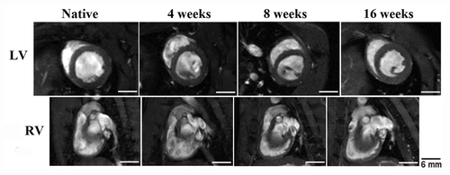 Figure 9. UBM patched hearts showed no geometric changes in the RV and LV when compared with native hearts that had not undergone surgery. The LV of reconstructed hearts maintains its native circular shape through the end of the study, indicating minimal pressure changes within the RV after patch implantation. Scale indicates 6 mm.