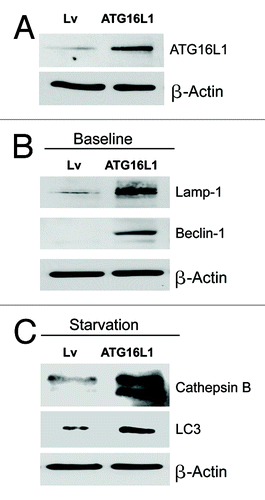 Figure 6. Fibroblasts overexpressing ATG16L1 show constitutive activation of the autophagic program. (A) ATG16L1 functions as a clathrin adaptor protein during autophagy, facilitating the recruitment of plasma membrane, by driving autophagosome formation via endocytosis. To assess the functional role of stromal ATG16L1 in breast cancer development, we stably overexpressed ATG16L1 in hTERT fibroblasts. (B) Note that ATG16L1 overexpression induces the upregulation of Beclin1 and Lamp1, under basal cell culture conditions. (C) Similarly, increases in cathepsin B and LC3 were also observed after overnight starvation (in Hepes-buffered HBSS). In all three panels, β-actin expression was assessed as a control for equal protein loading. Lv- represents fibroblasts transduced with the vector alone control, namely Lv-105 (puro).