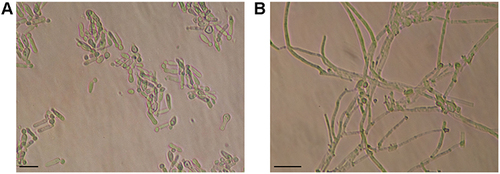 Figure 2 Microscopic morphology of Sporothrix globosa growing in the yeast–peptone–dextrose medium for 4 days. (A) Yeast-like cells growing at 35°C and pH 7.8, with the typical elongated cigar shape. (B) Mycelium growing at 28°C and pH 4.5, with globose conidia and branching septate hyphae. Scale bars = 10 µm.