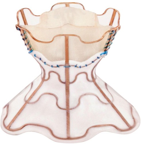 Figure 1 The V-Wave® interatrial shunt device.