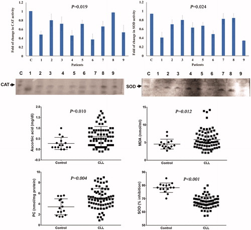 Figure 1. Serum levels of oxidative stress parameters, using spectrophotometric and native gel electrophoresis, in CLL patients. Ascorbic acid, MDA, and PC levels were significantly elevated in CLL patients more than their levels in healthy controls. SOD was significantly decreased in CLL group than healthy controls. The results of native gel electrophoresis were obtained from three independent experiments. There were significant decreases in SOD and catalase levels in CLL patients when compared with their corresponding levels in healthy controls.