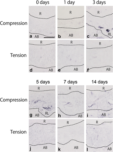 Figure 4. Microphotographs of sodium voltage-gated channel beta subunit 3 (SCN3B) in the intact periodontal ligament (PDL) (a, d) and the PDL after 1 (b, e), 3 (c, f), 5 (g, j), 7 (h, k), and 14 (i, l) days of the tooth movement. The intact PDL (day 0) has a few SCN3B-immunoreactive (IR) nerve fibres, whereas many nerve fibres are detected within the resorption lacuna (RL) in the compression area on day 5. The number of SCN3B-IR nerve fibres decreases 14 days after the tooth movement. R; root, AB; alveolar bone. Scale bar = 50 μm (a). All panels are at the same magnification.