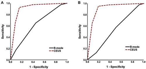 Figure 5 Receiver operating characteristic curves for differentiating benign and malignant splenic lesions after review of B-mode (continuous line) and CEUS (dotted line) sonograms. For reader 1 (A), the diagnostic confidence increased from 0.622 with B-mode US to 0.908 with CEUS and for reader 2 (B), the diagnostic confidence increased from 0.533 with B-mode to 0.906 with CEUS. The improvement in diagnostic confidence after review of CEUS was statistically significant (p < 0.001) for both readers.
