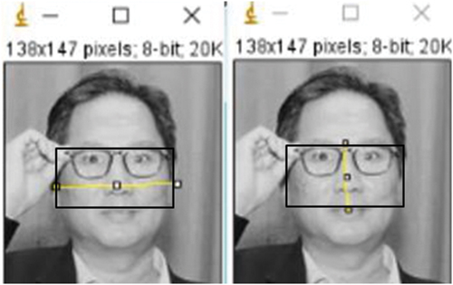 Figure 2. Facial Width to Height Ratio (fWHR) male CEO measurement.