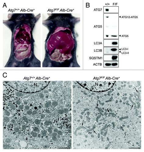 Figure 1. ATG7 deficiency in mouse liver causes hepatomegaly and reveals signs of defective autophagy. (A) Gross anatomical view of a representative Atg7+/+ Alb-Cre+ and Atg7F/F Alb-Cre+ mouse (5 mo old). (B and C) western blot (B) and ultrastructural analysis (C) of liver samples from Atg7+/+ Alb-Cre+ and Atg7F/F Alb-Cre+ mice. Ultrastructural inspection of Atg7F/F Alb-Cre+ livers reveals accumulation of elongated and deformed mitochondria (black arrows) as well as a decrease in glycogen granules and endoplasmic reticulum. Livers from Atg7+/+ Alb-Cre+ mice show normal cell morphology. Scale bar, 2 μm. n, nucleus.
