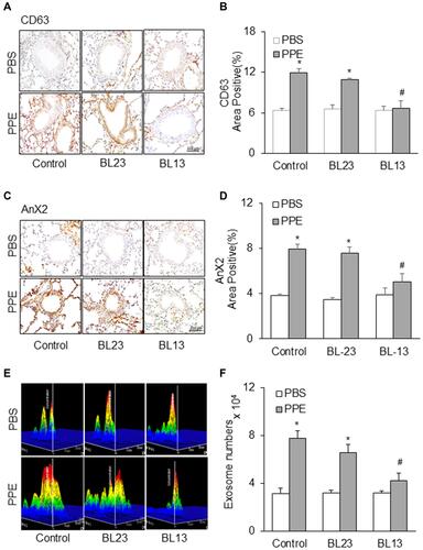 Figure 8 Effects of electroacupuncture at the acupoint Feishu (BL13) and Shenshu (BL23) on increases in exosome release induced by PPE instillation. Representative images depicts (A) CD63 (C) AnX2 immunostaining in the lung of mice. (B and D) Summarized data in the bar graph shows decreased exosome levels during electroacupuncture treatment. (E) Representative images showed exosome release and (F) Bar graph shows electroacupuncture decreased exosome counts in lung lavages from mice receiving PPE instillation. (n=6). *P<0.05 vs PBS treatment. #P<0.05 vs PPE mouse group without EA or mice receiving EA at lung-nonspecific acupoint, BL23.