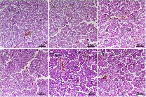 Figure 1. Hematoxylin and eosin (H &E) staining of renal in CdCl2 exposure after the treatment with fucoxanthin and Shenfukang tablets supplementation (1) the control group: no CdCl2 administration; (2) NCG, negative control group, only CdCl2 treatment; (3) PCG, positive control group, CdCl2+ Shenfukang tablets; (4) F1, CdCl2 + 10 mg/kg fucoxanthin body weight for 14 day treatment ; (5) F2, CdCl2 + 25 mg/kg body weight fucoxanthin; (6) F3,CdCl2 + 50 mg/kg body weight fucoxanthin. Each group used 20 mice