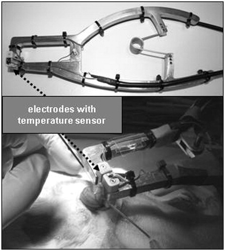 Figure 1. Illustration of anastomotic device while fusing a rat caecum.