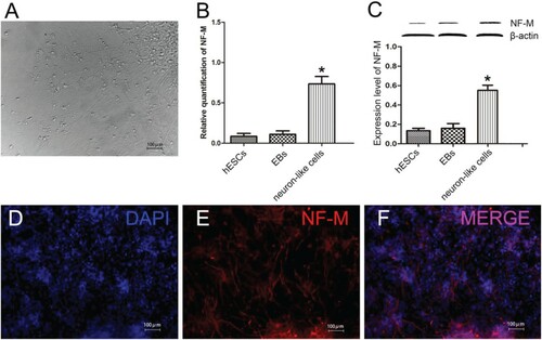Figure 3. Neural differentiation of EBs in vitro for 12 days. (A) Neuron-like cells after EBs adherent culture; (B)The gene expression levels of NF-M; (C) The protein expression of NF-M; (D-F) Immunofluorescence staining of NF-M in neuron-like cells; (A, D-F: Scale bars = 100 µm; B, C: *P < 0.05, neuron-like cells compared with hESCs and EBs; β-actin: internal reference).