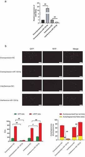 Figure 1. miR-129-5p reduces neuronal cell autophagy. (a) Overexpression and interference of miR-129-5p in neuronal cells cultured in vitro, and qPCR detection of miR-129-5p expression (b) mRFP-GFP-LC3 fusion protein infected neuronal cells to trace the formation of autophagy. The results followed by overexpression of miR-129-5p, the red dots of mRFP represent the degree of autophagy. Scale bar: 50 μm. #, p < 0.05; ##, p < 0.01.