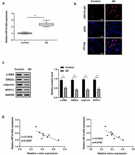 Figure 1. Expression levels of HIF1A-AS2 and contractile phenotypes markers in human aortic tissues. (a) HIF1A-AS2 was elevated in AD tissues (n = 8) versus to that of control (n = 8) by qRT-PCR and (b) FISH assay (Scale bar = 25 μm). (c) The SMC contractile phenotypes markers (α-SMA, SM22α, calponin, and MYH11) were reduced in human AD tissues relative to that of control by Western blotting assay. (d) The correlation between HIF1A-AS2 and contractile phenotype markers (α-SMA, SM22α) were negatively. *P < 0.05, **P < 0.01.