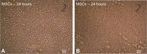Figure 1 Morphology characteristics of mouse MSCs cultured in MEM +20% FBS after 24 hours as revealed under inverted microscope.