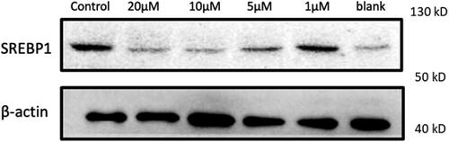 Figure 2. The effect of taurine-conjugated lithocholic acid on protein expression of SREBP1. n = 3.