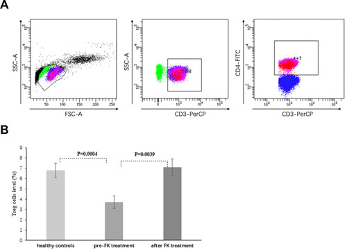 Figure 1 Regulatory T cells in peripheral blood before and after FK. (A) Total events of 50,000 were gated based on FSC and SSC characteristics, and dot plots for Treg cells were gated on CD4+ cells. Treg cells were defined as CD4+CD25+foxP3+ co-expression and expressed as a percentage of the total CD4+ T population. (B) The expression of Treg cells from 31 patients who achieved at least PR was tested before and 6 months after FK treatment. Eight age- and sex-matched normal volunteers were used as controls. Levels of Treg cells pre-FK were much lower compared to healthy controls, but increased significantly after FK treatment. FSC, forward-scatter characteristics; SSC, side-scatter characteristics; Treg cells, T regular cells; FK, tacrolimus; PR, partial response.