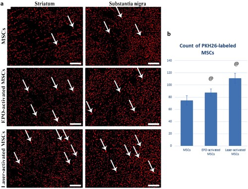 Figure 10. (a & b): (a) PKH26-labeled immunofluorescent images showing enhanced homing of the MSCs into the corpus striatum and substantia nigra with Laser and erythropoietin activation. (b): Statistical analysis of PKH26-labeled MSCs in MSCs, EPO-activated MSCs, and Laser-activated MSCs. Values are presented as mean ± SD. @ statistically significant compared to the corresponding value in the MSCs group (P < 0.05). &: statistically significant compared to the corresponding value in EPO-activated MSCs group (P < 0.05) (n = 8).