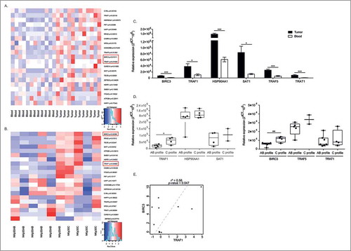 Figure 1. Comprehensive transcriptomics analyses revealing TRAF1 and cIAP2/BIRC3 in NK TILs from GIST. (A-B) Heat map representation of microarray analyses of CD3-CD56bright NK cells from paired blood and tumors (A) in NKp30 AB versus C profiles (B) on about 20,000 gene products, the most significant hits contrasting the two groups according to the median of the whole cohort being depicted. Of note, for the genes products identified by several distinct probe sets, the most variant was retained in the model. p-values (one-sided differential test) are indicated on the right side for each significant gene product. (C-D) RT-PCR evaluation of the transcription of each gene product pre-selected from the microarray analyses, comparing blood versus tumor expression in at least 3 GIST bearing patients (C) or NKp30AB versus NKp30C profiles (D). (E) Scatter plot, Pearson correlations coefficient and p-value between TRAF1 and BIRC3 transcript abundancy in tumors. Each dot represents one HV or patient. Wilcoxon matched pairs test: * p < 0.05, ** p < 0.01, *** p < 0.001.