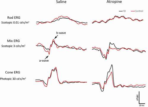 Figure 4. a-Wave amplitudes in the photopic (a), scotopic (c) adapted ERG. The comparison of the FDM eyes between two groups in the photopic (b), scotopic (d) adapted ERG (mean ± SEM). In the photopic ERG (a), the saline-treated FDM eyes show a declining trend in a-wave amplitudes compared to the control eyes. The differences were not statistically significant. The amplitudes in the atropine-treated FDM eyes were higher than the control eyes under the stimulation of 1 and 3 cd·s/m2 (A, paired t-test). The a-wave amplitudes increased significantly in the atropine-treated FDM eyes compared to the saline group under the stimulation of 10 and 30 cd·s/m2 (a and b, two-way repeated measures ANOVA with Bonferroni post hoc test). In the scotopic ERG, the a-wave amplitudes of atropine-treated FDM eyes tended to be higher than those of the saline-treated FDM eyes under higher stimulus intensity, but the differences were not significant (c,d): *: P < .05, **: P < .01, n = 8