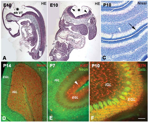 Figure 1. The development of the cerebellum. A and B show the cerebellar anlagen in sagittal (A) and coronal (B) sections at E10 (hematoxylin and eosin staining). Cerebellum was developed from upper and inner rhombic lips (arrow heads) which connected with choroid (stars), and the space surrounded by the rhombic lips and choroid was the 4th ventricle (VT). Photo C shows P10 cerebellum with Nissl staining. Some cells (→) are located in the superficial external granular layer (EGL), while some granule cells have migrated into the internal granular layer (IGL). With cell migration, the cell density in the EGL became sparse, and there are few cells still remaining in the superficiality of the EGL or molecular layer. The area between the EGL and IGL is presumed to be the Purkinje cell layer (arrow head). Photo D shows the cerebellum at P14 (Tublin and NeuN double immunofluorescent labeling). A row of Purkinje cells (green) was seen in the Purkinje cell layer (PCL), and their dendrites extended into the EGL. The IGL contained numerous granule cells (red) underneath the PCL. Photo E shows the cerebellar lamination and cell migration at P7 with Ki67 (red) and NeuN (green) immunofluorescent labeling. At this age, the three-layered structure of cerebellar lamination was formed, and EGL and IGL could be clearly recognized. The Ki67 positive cells (arrow head) in EGL were migrating toward IGL to form the mature granule cells (green). Photo F shows the P10 cerebellum with functional presynaptic buttons (synaptophysin and calbindin double immunolabeling), which were located in EGL and IGL (red). These presynaptic buttons in EGL can be connected with the dendrites of Purkinje cells (green). Scale bars: A and B: 200 µm; C and D: 80 µm; E: 60µm; F: 30 µm.