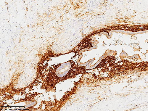 Figure 8 Immunohistochemical investigation subsequent to partial intestinal resection.