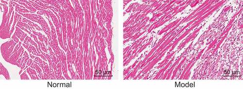 Figure 1. I/R rats show severe pathological changes in myocardial tissues (× 400). I/R, ischemia-reperfusion.