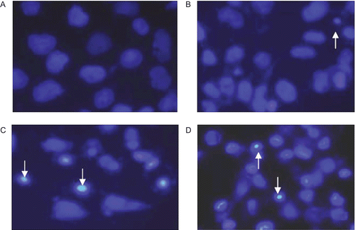 Figure 4.  Morphological changes of SMMC-7721 cells detected by Hoechst 33258 staining (×400). After untreated (A) and treated with 1.0 µg/mL (B), 2.0 µg/mL (C), 4.0 µg/mL (D) Aikete injection for 48 h, cells were stained with Hoechst 33258 and observed under fluorescence microscope. Arrows indicate apoptotic cells.