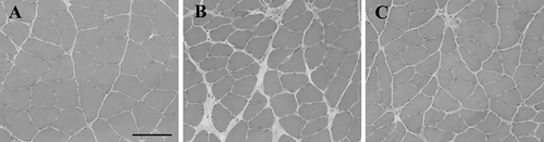 Figure 1. Histological observation of the soleus muscle stained with hematoxylin and eosin. No muscle fiber necrosis or regenerating fibers were observed in the muscles. In the immobilization and muscle control groups, atrophic changes in the muscle fibers were observed and compared with that of the control group. A: Control group. B: Immobilization group. C: Muscle contraction group. Magniﬁcation 100×, scale bar = 100 µm.