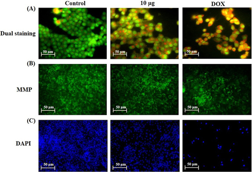 Figure 10 Effect of GO/PEG/Bru-FA NCs on the apoptosis and MMP level in the HepG2 cells. The HepG2 cells revealed an increased yellow and Orange fluorescence after treatment with 10 μg/mL of GO/PEG/Bru-FA NCs or 2 μg of standard drug DOX, which indicates the occurrence of apoptosis (A). The GO/PEG/Bru-FA NCs treatment (10 μg/mL) causes a considerable decrease in the MMP level of HepG2 cells. The control cells revealed more green fluorescent cells, which indicates normal and intact MMP (B). The 10 μg/mL of GO/PEG/Bru-FA NCs treatment revealed a higher incidences of cell and nuclear damages, loss in cell numbers, and appearance of apoptotic bodies, which showed that the GO/PEG/Bru-FA NCs treatment promoted apoptosis in the HepG2 cells. The fluorescent microscope was utilized to detect the intensity of the fluorescence (C). Scale bar: 50 μm.