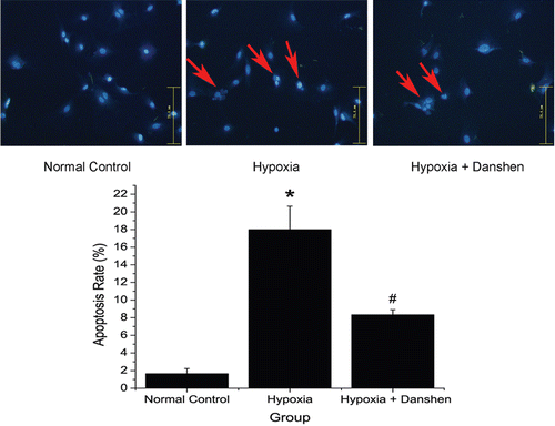 Figure 7.  Apoptosis rate in different treatment groups. Normal control group: cells cultured in normal oxygen condition; hypoxia group: cells cultured in 2% O2 for 8 h; hypoxia + Danshen group: cells pretreated with 1.8 mg/mL Danshen and then cultured in 2% O2 for 8 h. Apoptosis cells show nuclear fragmentation and condensation (red arrows). The apoptotic index was determined by the number of positively stained apoptotic cardiomyocytes/the total number of cardiomyocytes counted ×100%. (*p < 0.05: compared with normal control group; #p < 0.05: compared with hypoxia group.)